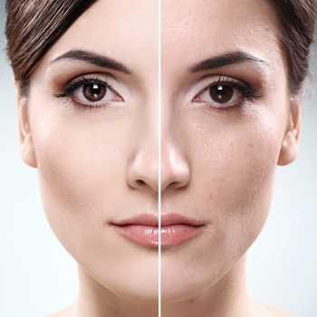 dermacell collagen cream 30ml large 2