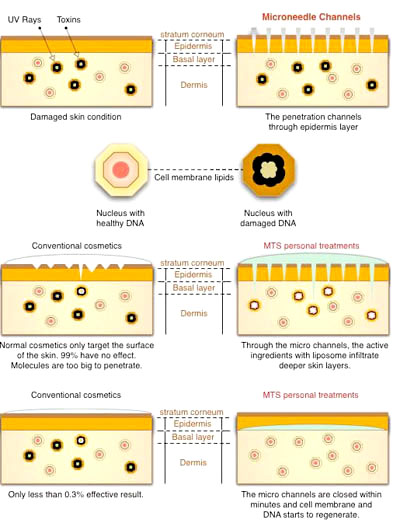 dermaroller vs collagen creams